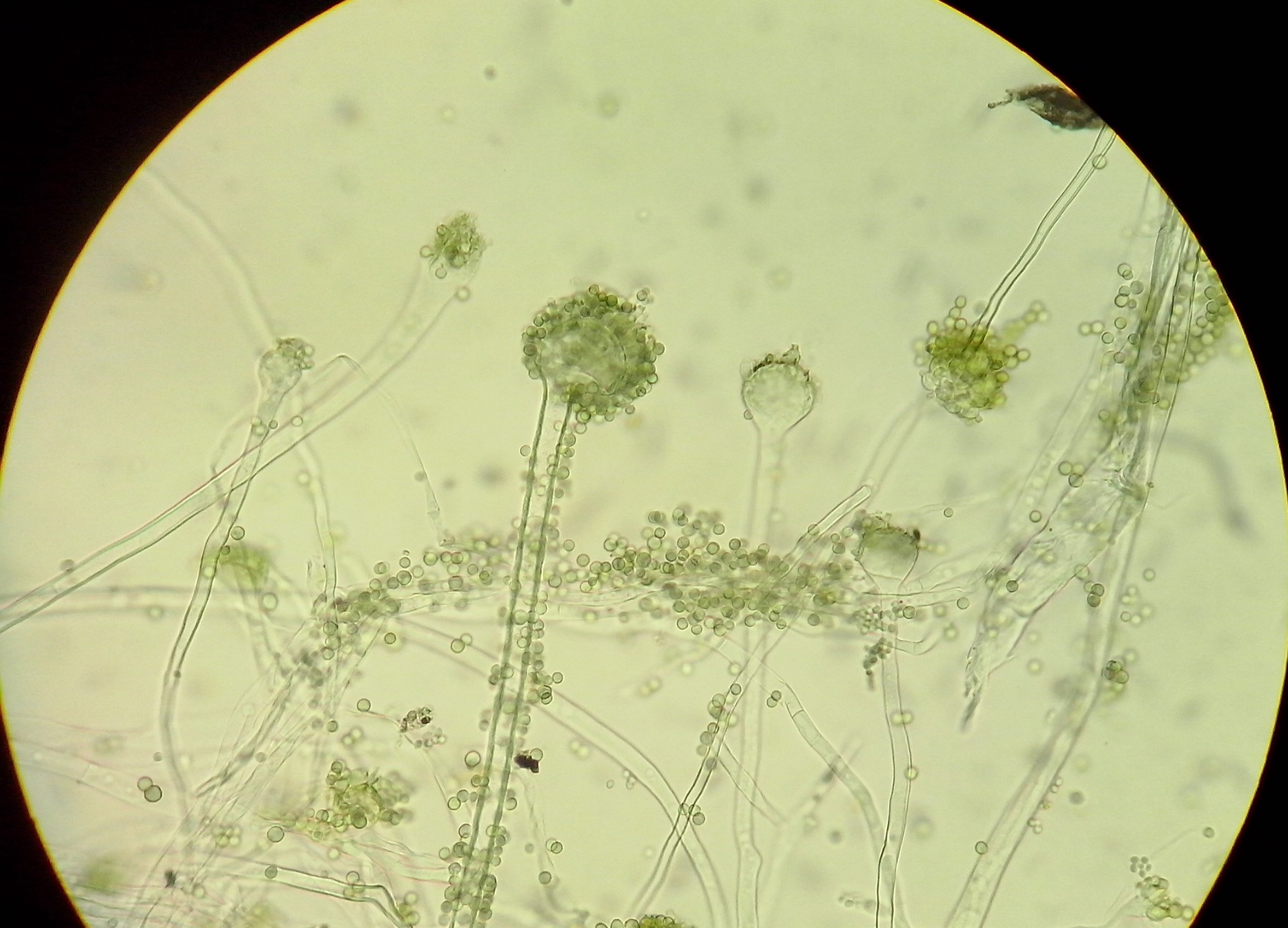 Microscopic view of Aspergillus oryzae growing on rice, the koji fermentation organism associated with Kojic Acid production